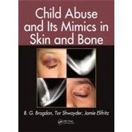 Child Abuse and Its Mimics in Skin and Bone by Brogdon; B. G., 9781439855355