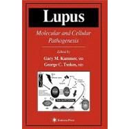 Lupus by Kammer, Gary M.; Tsokos, George C., 9780896035560