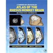 A Combined MRI and Histology Atlas of the Rhesus Monkey Brain in Stereotaxic Coordinates by Saleem; Logothetis, 9780123725592