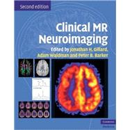 Clinical MR Neuroimaging: Physiological and Functional Techniques by Edited by Jonathan H. Gillard , Adam D. Waldman , Peter B. Barker, 9780521515634
