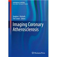 Imaging Coronary Atherosclerosis by Nicholls, Stephen J.; Crowe, Tim, 9781493905713
