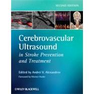 Cerebrovascular Ultrasound in Stroke Prevention and Treatment by Alexandrov, Andrei V.; Hacke, Werner, 9781405195768