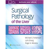 Surgical Pathology of the Liver by Torbenson, Michael; Moreira, Roger; Zhang, Lizhi, 9781496365798
