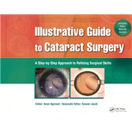 Illustrative Guide to Cataract Surgery by Amar Agarwal, 9781041255871