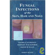 Fungal Infections of the Skin and Nails by Suhonen; Raimo E., 9781853175893