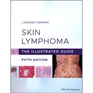 Skin Lymphoma The Illustrated Guide by Cerroni, Lorenzo, 9781119485902