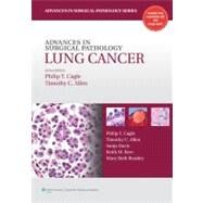 Advances in Surgical Pathology: Lung Cancer by Cagle, Philip T.; Allen, Timothy, 9781605475912