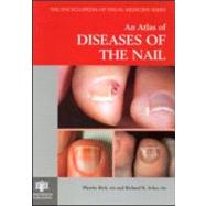 An Atlas of Diseases of the Nail by Rich; Phoebe, 9781850705956
