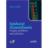 Epidural Anaesthesia: Images, Problems and Solutions by Collier; Clive, 9781444156041
