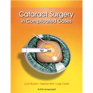 Cataract Surgery in Complicated Cases by Buratto, Lucio; Brint, Stephen; Caretti, Luigi, 9781617116070