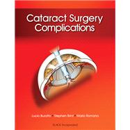 Cataract Surgery Complications by Buratto, Lucio; Brint, Stephen; Romano, Mario, 9781617116087