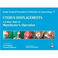 Uterus Displacements by Nagrath, Arun; Malhotra, Narendra, 9789351526117