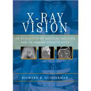 X-Ray Vision The Evolution of Medical Imaging and Its Human Significance by Gunderman, Richard B., 9780199976232