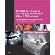 Skeletal Anchorage in Orthodontic Treatment of Class II Malocclusion: Contemporary Applications of Orthodontic Implants, Miniscrew Implants and Miniplates by Papadopoulos, Moschos A., 9780723436492