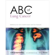 ABC of Lung Cancer by Hunt, Ian; Muers, Martin M.; Treasure, Tom, 9781405146524