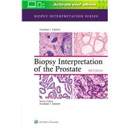 Biopsy Interpretation of the Prostate by Epstein, Jonathan I., 9781975136543