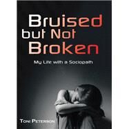 Bruised but Not Broken by Peterson, Toni, 9781982206550