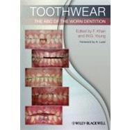 Toothwear The ABC of the Worn Dentition by Khan, Farid; Young, William G.; Lussi, Adrian, 9781444336559