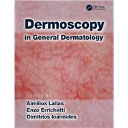 Dermoscopy in General Dermatology by Lallas; Aimilios, 9781138706569