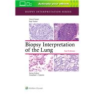 Biopsy Interpretation of the Lung by Suster, Saul; Suster, David, 9781975136581