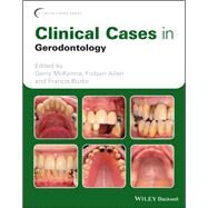 Clinical Cases in Gerodontology by McKenna, Gerry; Allen, Finbarr; Burke, Francis, 9781119226598