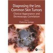 Diagnosing the Less Common Skin Tumors by Longo, Caterina, M.D., Ph.D., 9781138106628