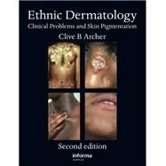 Ethnic Dermatology by Archer, Clive B., 9780367386634