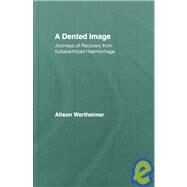 A Dented Image: Journeys of recovery from subarachnoid haemorrhage by Wertheimer, Alison, 9780415386715