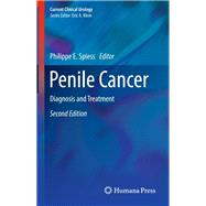 Penile Cancer by Spiess, Philippe E., 9781493966776