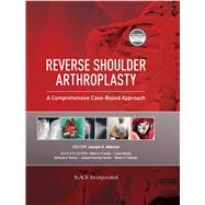 Reverse Shoulder Arthroplasty by Abboud, J., 9781630916855