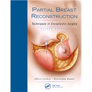 Partial Breast Reconstruction by Losken, Albert, M.D.; Hamdi, Moustapha, M.D., Ph.D., 9781626236912