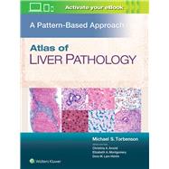 Atlas of Liver Pathology: A Pattern-Based Approach by Torbenson, Michael, 9781496396976
