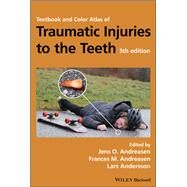 Textbook and Color Atlas of Traumatic Injuries to the Teeth by Andreasen, Jens O.; Andreasen, Frances M.; Andersson, Lars, 9781119167051