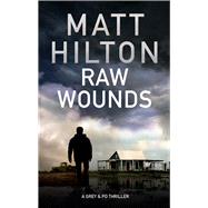 Raw Wounds by Hilton, Matt, 9780727887054