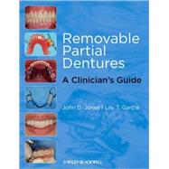 Removable Partial Dentures A Clinician's Guide by Jones, John D.; García, Lily T., 9780813817064