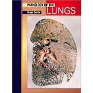 PATHOLOGY OF THE LUNGS,Corrin,9780443057137