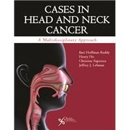 Cases in Head and Neck Cancer: A Multidisciplinary Approach by Ruddy, Bari Hoffman, Ph.D., 9781597567152