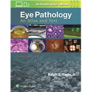 Eye Pathology An Atlas and Text by Eagle, Ralph C., 9781496337177