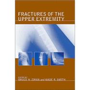 Fractures of the Upper Extremity by Ziran; Bruce H., 9780824747183