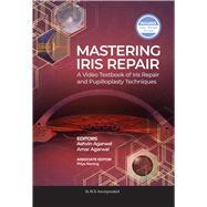Mastering Iris Repair by Agarwal, Ashvin; Agarwal, Amar, 9781630917265