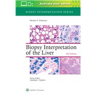 Biopsy Interpretation of the Liver by Torbenson, Michael, 9781975157296