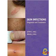 Skin Infections: Diagnosis and Treatment by Edited by John C. Hall , Brian J. Hall, 9780521897297