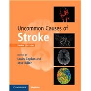 Uncommon Causes of Stroke by Caplan, Louis R.; Biller, Jose, 9781107147447