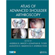 Atlas of Advanced Shoulder Arthroscopy by Imhoff; Andreas B., 9781498787482