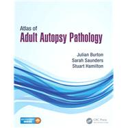 Atlas of Adult Autopsy Pathology by Burton; Julian, 9781444137521
