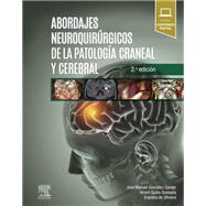 Abordajes neuroquirrgicos de la patologa craneal y cerebral by Jos Manuel Gonzlez Darder; Vicent Quilis Quesada; Evandro de Oliveira, 9788491137740