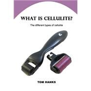 What Is Cellulite?: The Different Types of Cellulite by Hanks, Tom, 9781505997743