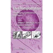 Liver Transplantation by Everson, Gregory T.; Trotter, James F., M.D., 9781617377822