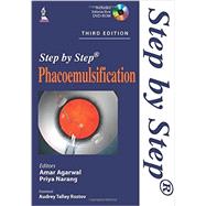 Phacoemulsification by Agarwal, Amar; Narang, Priya, 9789351527831