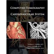 Computed Tomography of the Cardiovascular System by Gerber, Thomas C., M.D.; Kantor, Birgit, M.D.; Williamson, Eric E., M.D., 9780367387839